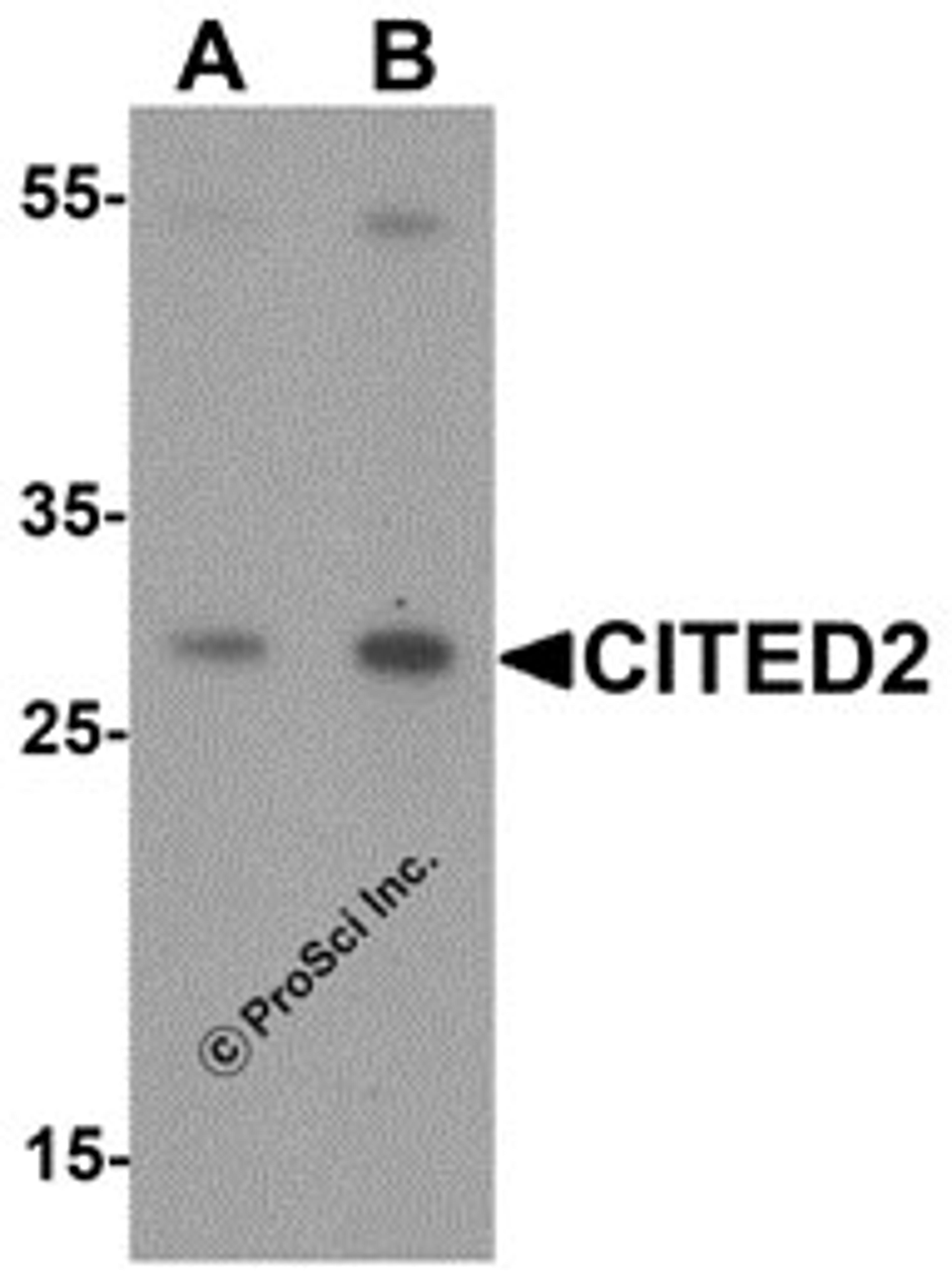 Western blot analysis of CITED2 in Jurkat cell lysate with CITED2 antibody at (A) 1 and (B) 2 μg/mL.