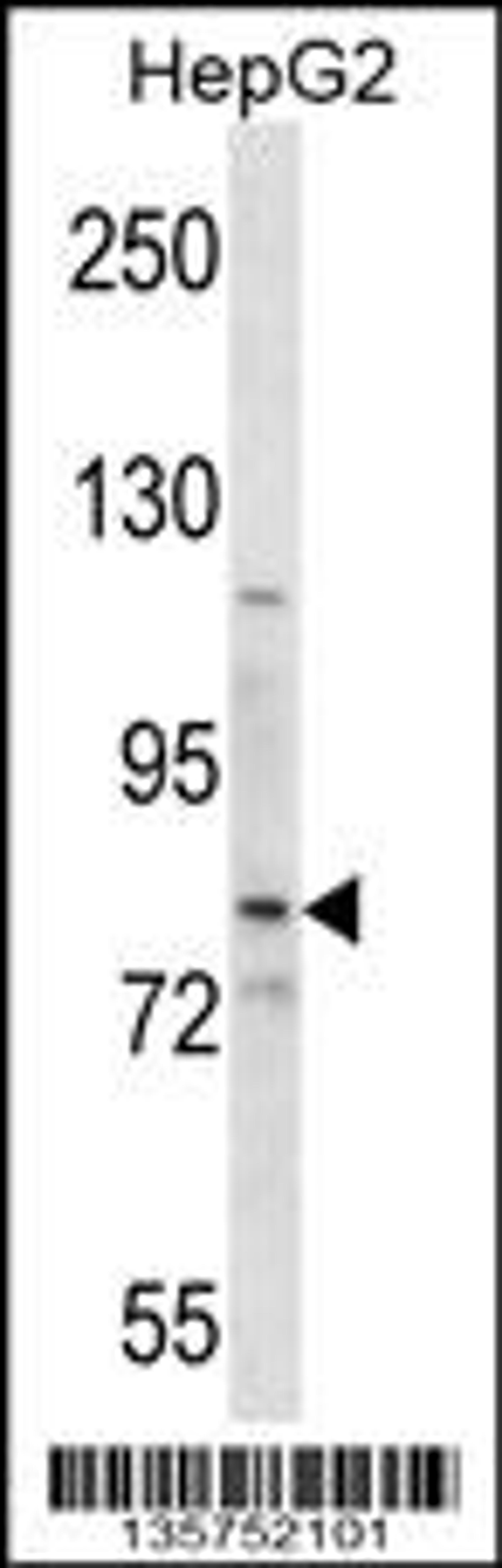 Western blot analysis in HepG2 cell line lysates (35ug/lane).