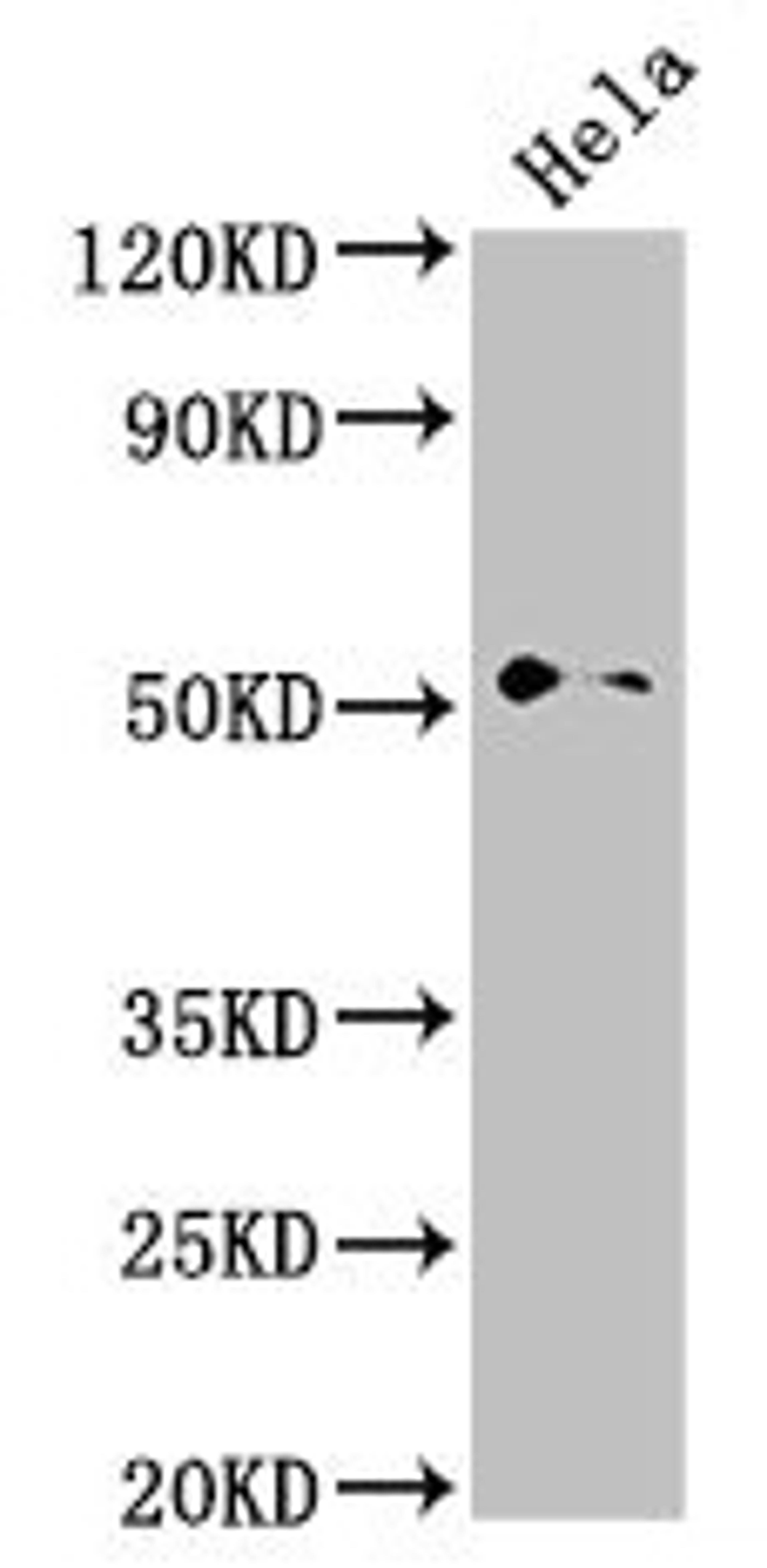 Western Blot. Positive WB detected in: Hela whole cell lysate. All lanes: NR0B1 antibody at 2.8µg/ml. Secondary. Goat polyclonal to rabbit IgG at 1/50000 dilution. Predicted band size: 52, 44 kDa. Observed band size: 52 kDa