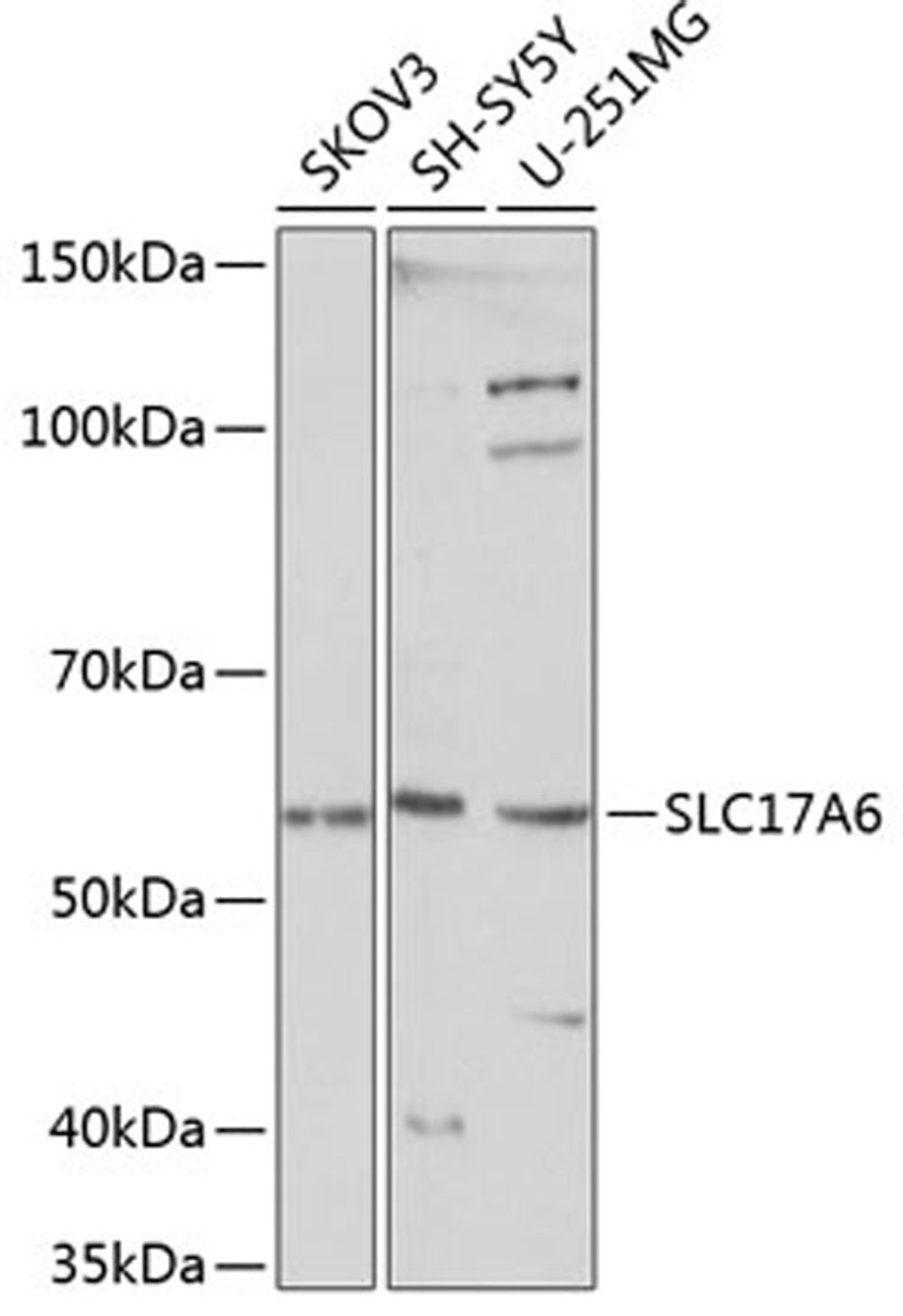 Western blot - SLC17A6 Polyclonal Antibody (A15177)