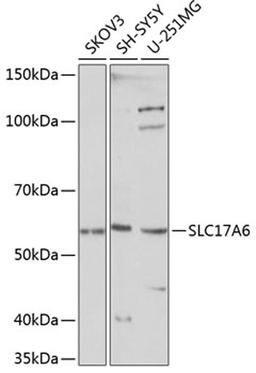 Western blot - SLC17A6 Polyclonal Antibody (A15177)