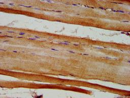 IHC image of CSB-PA007909LA01HU diluted at 1:600 and staining in paraffin-embedded human skeletal muscle tissue performed on a Leica BondTM system. After dewaxing and hydration, antigen retrieval was mediated by high pressure in a citrate buffer (pH 6.0). Section was blocked with 10% normal goat serum 30min at RT. Then primary antibody (1% BSA) was incubated at 4°C overnight. The primary is detected by a biotinylated secondary antibody and visualized using an HRP conjugated SP system.
