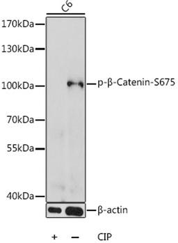 Western blot - Phospho-ß-Catenin-S675 antibody (AP0795)