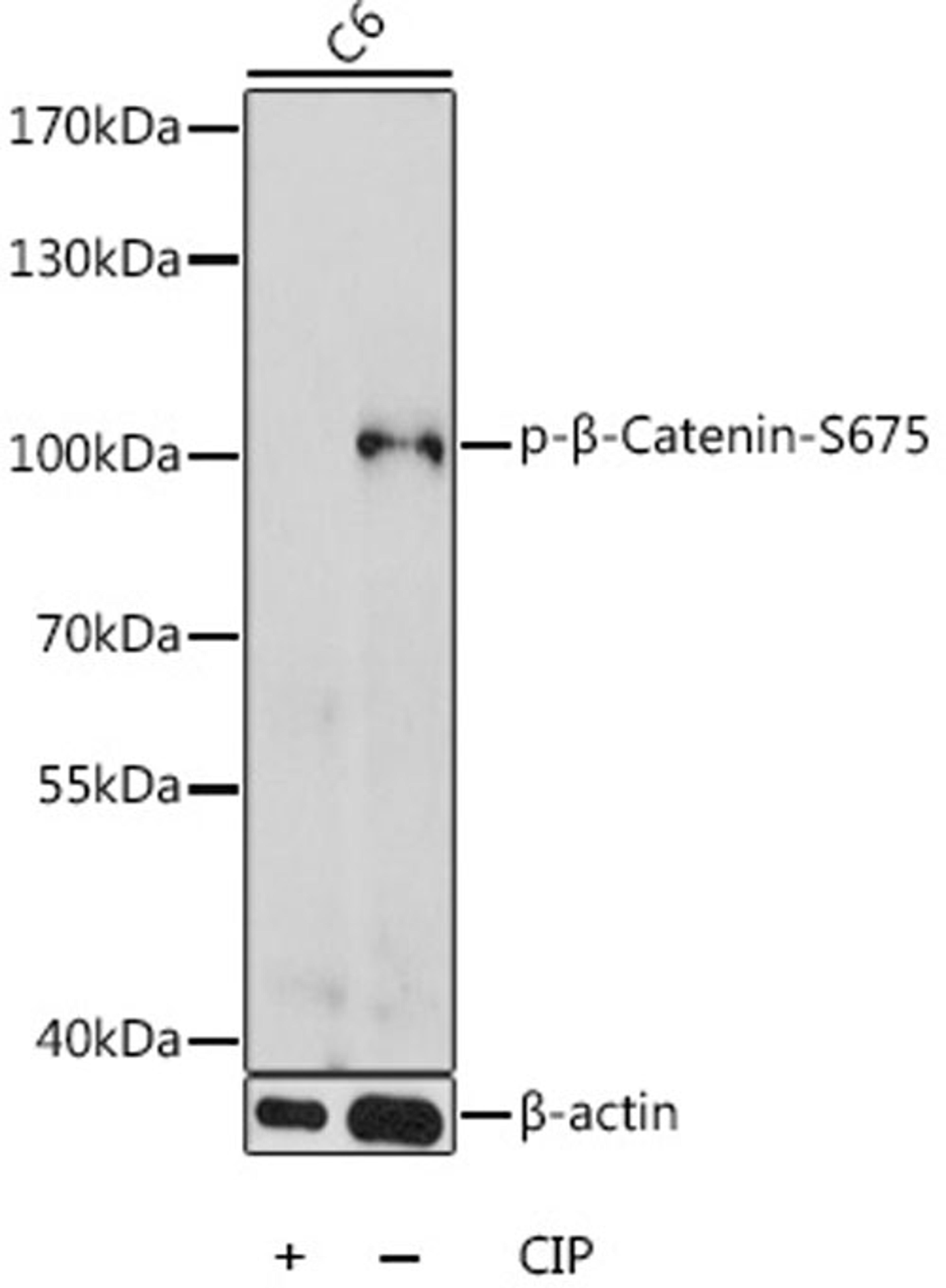 Western blot - Phospho-ß-Catenin-S675 antibody (AP0795)