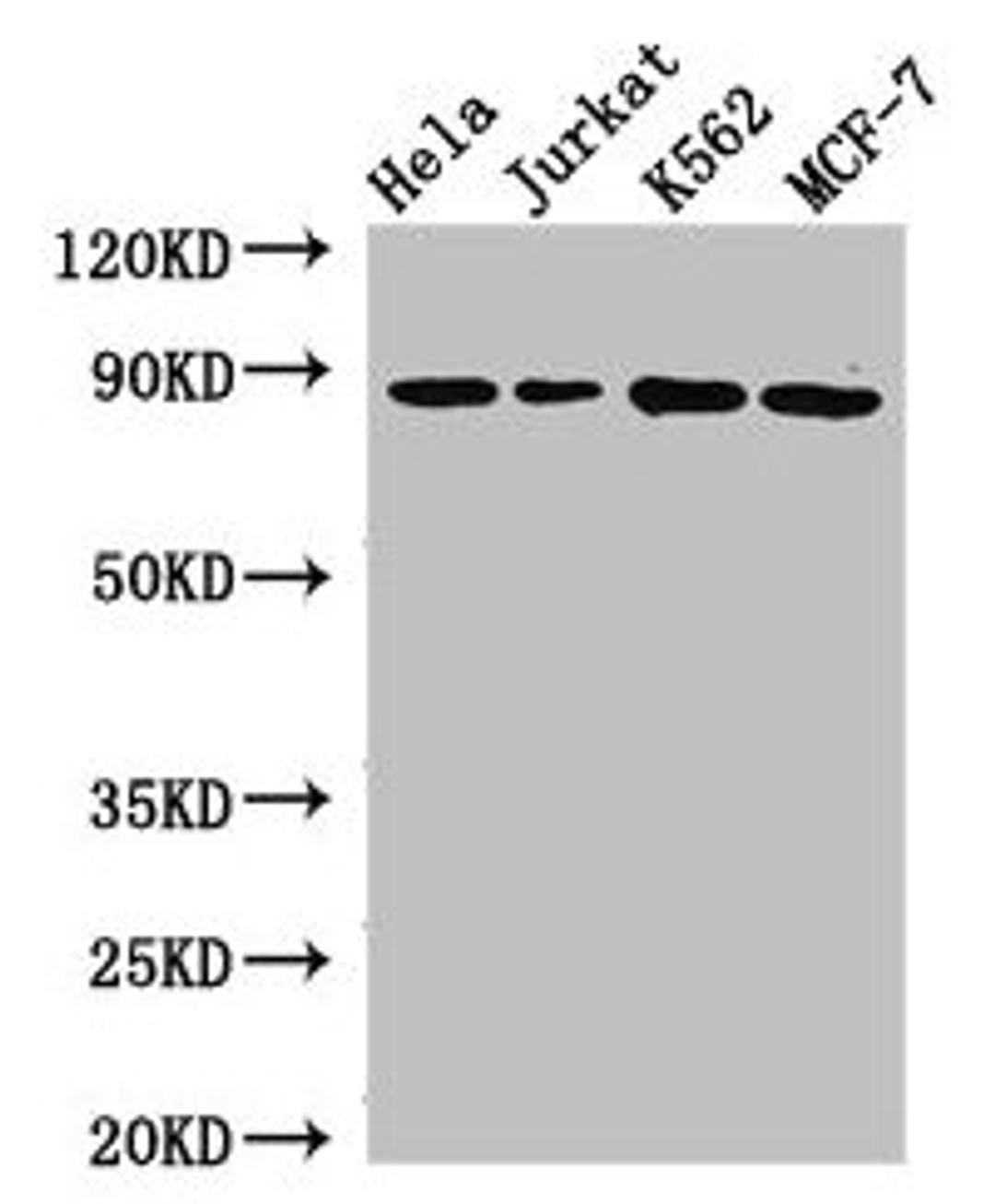 Western Blot. Positive WB detected in: Hela whole cell lysate, Jurkat whole cell lysate, K562 whole cell lysate, MCF-7 whole cell lysate. All lanes: CANX antibody at 2.7µg/ml. Secondary. Goat polyclonal to rabbit IgG at 1/50000 dilution. Predicted band size: 68, 72, 56 kDa. Observed band size: 88 kDa