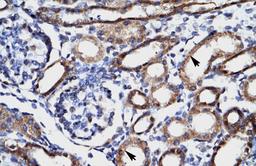 Antibody used in IHC on Human kidney.