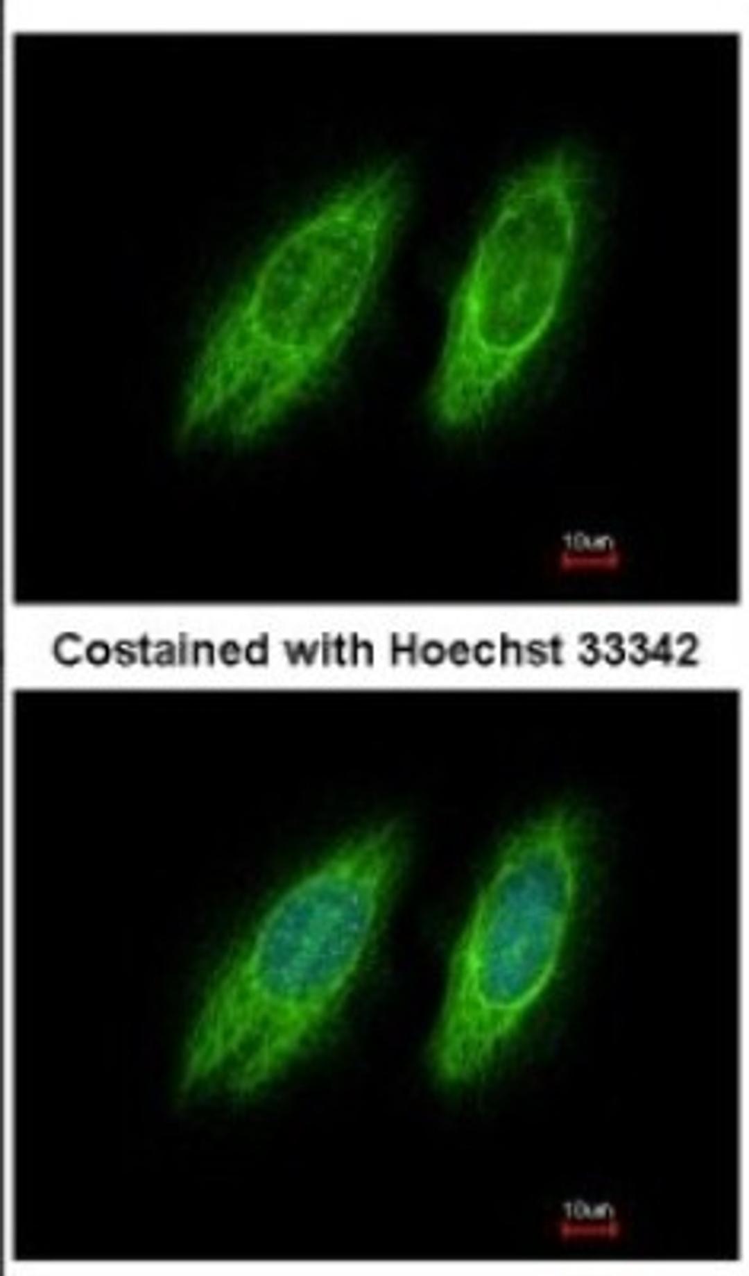 Immunocytochemistry/Immunofluorescence: GBF1 Antibody [NBP2-16619] - Immunofluorescence analysis of methanol-fixed HeLa, using antibody at 1:200 dilution.