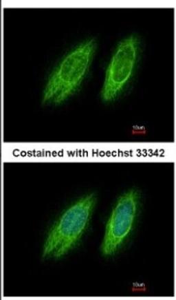 Immunocytochemistry/Immunofluorescence: GBF1 Antibody [NBP2-16619] - Immunofluorescence analysis of methanol-fixed HeLa, using antibody at 1:200 dilution.