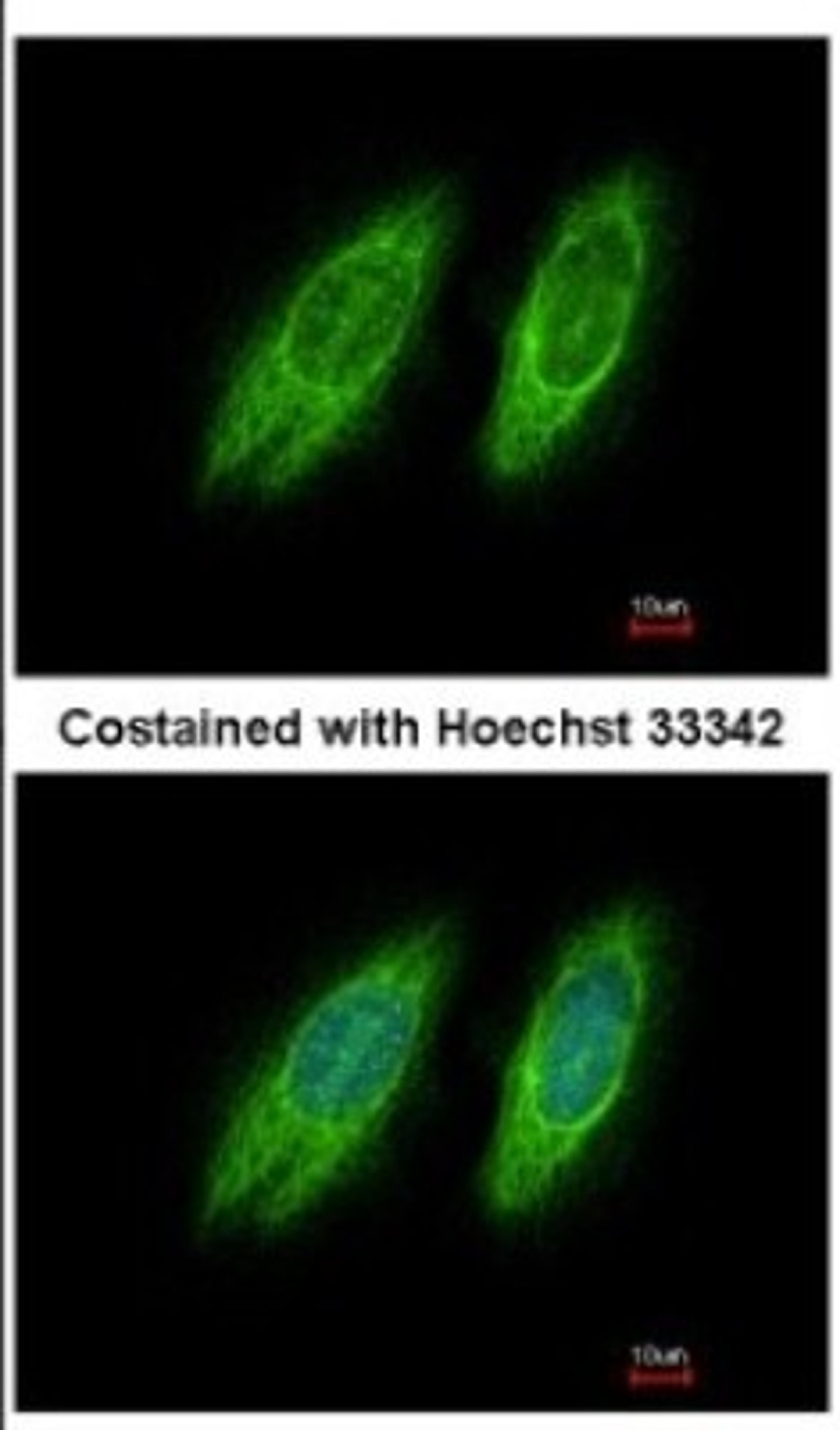 Immunocytochemistry/Immunofluorescence: GBF1 Antibody [NBP2-16619] - Immunofluorescence analysis of methanol-fixed HeLa, using antibody at 1:200 dilution.