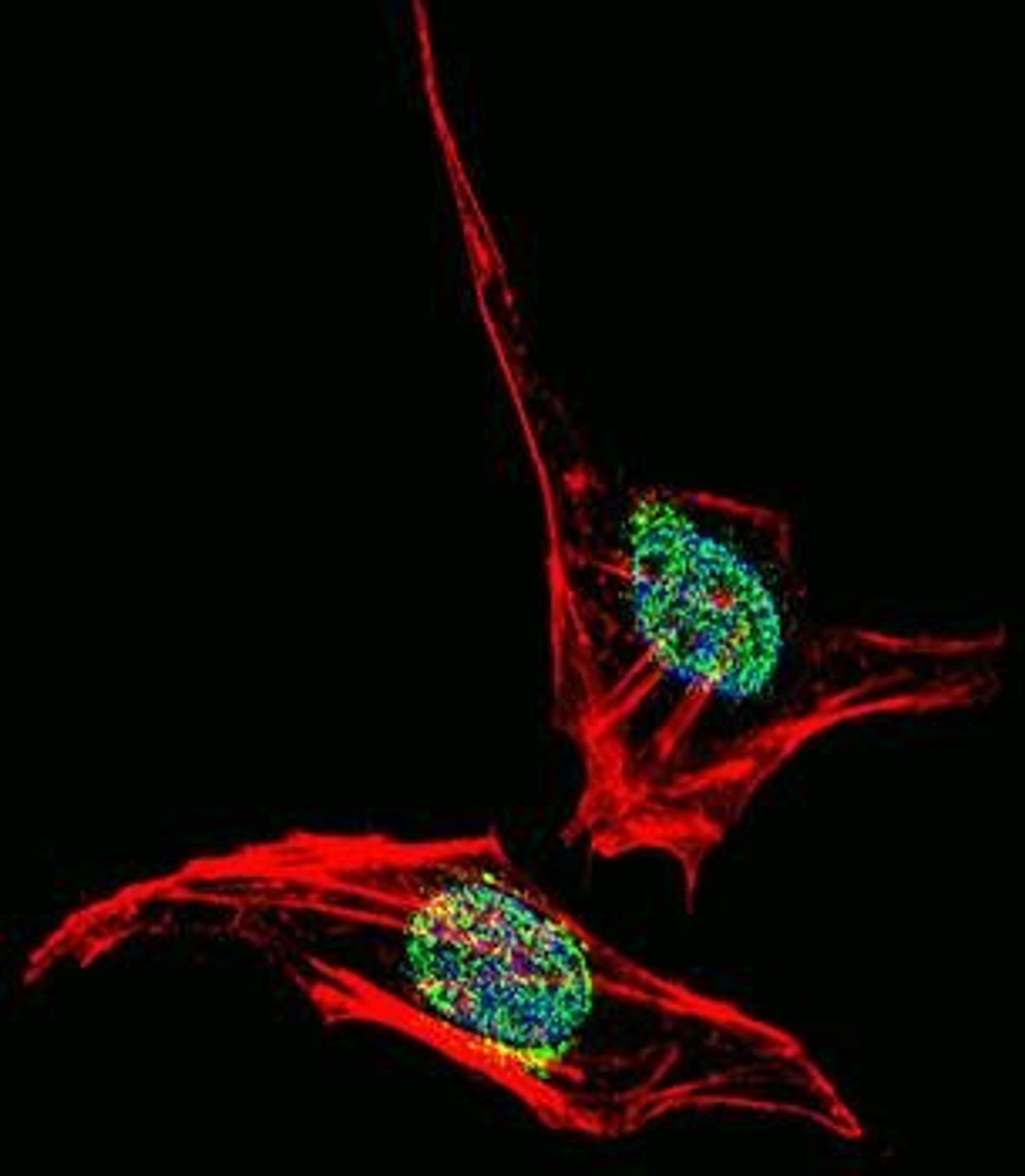 Immunofluorescense analysis of Hela cells using EN2 antibody (primary antibody dilution at: 1:10-50)