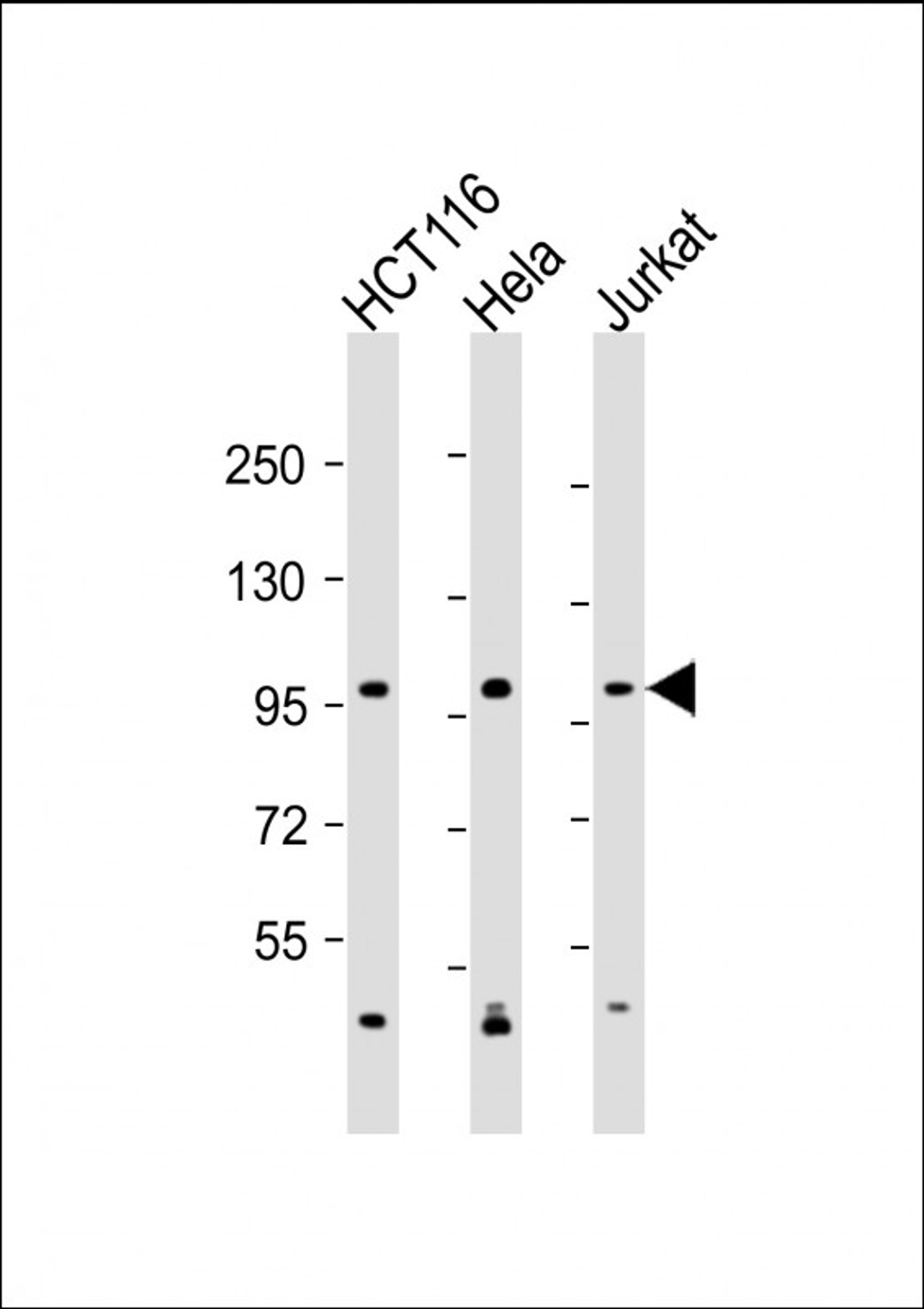 Western Blot at 1:2000 dilution Lane 1: HCT116 whole cell lysate Lane 2: Hela whole cell lysate Lane 3: Jurkat whole cell lysate Lysates/proteins at 20 ug per lane.