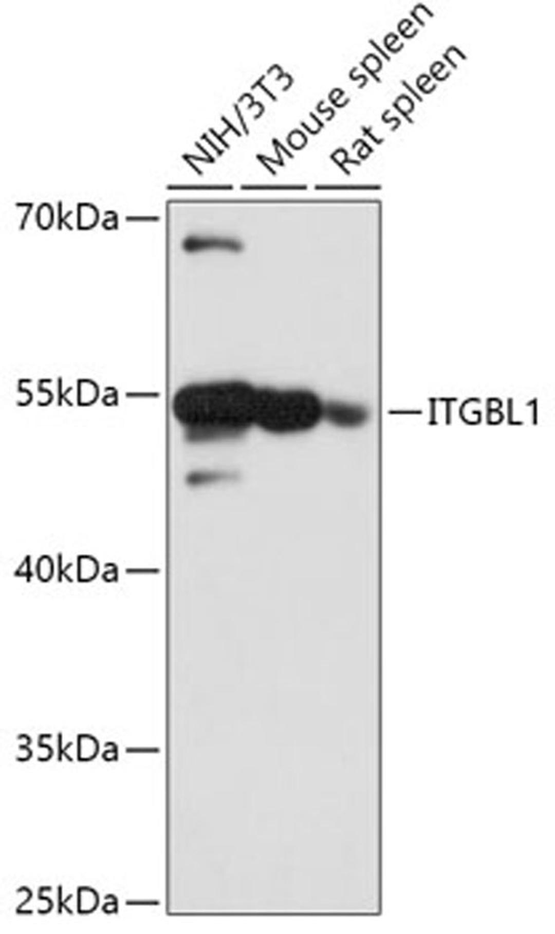 Western blot - ITGBL1 antibody (A17592)