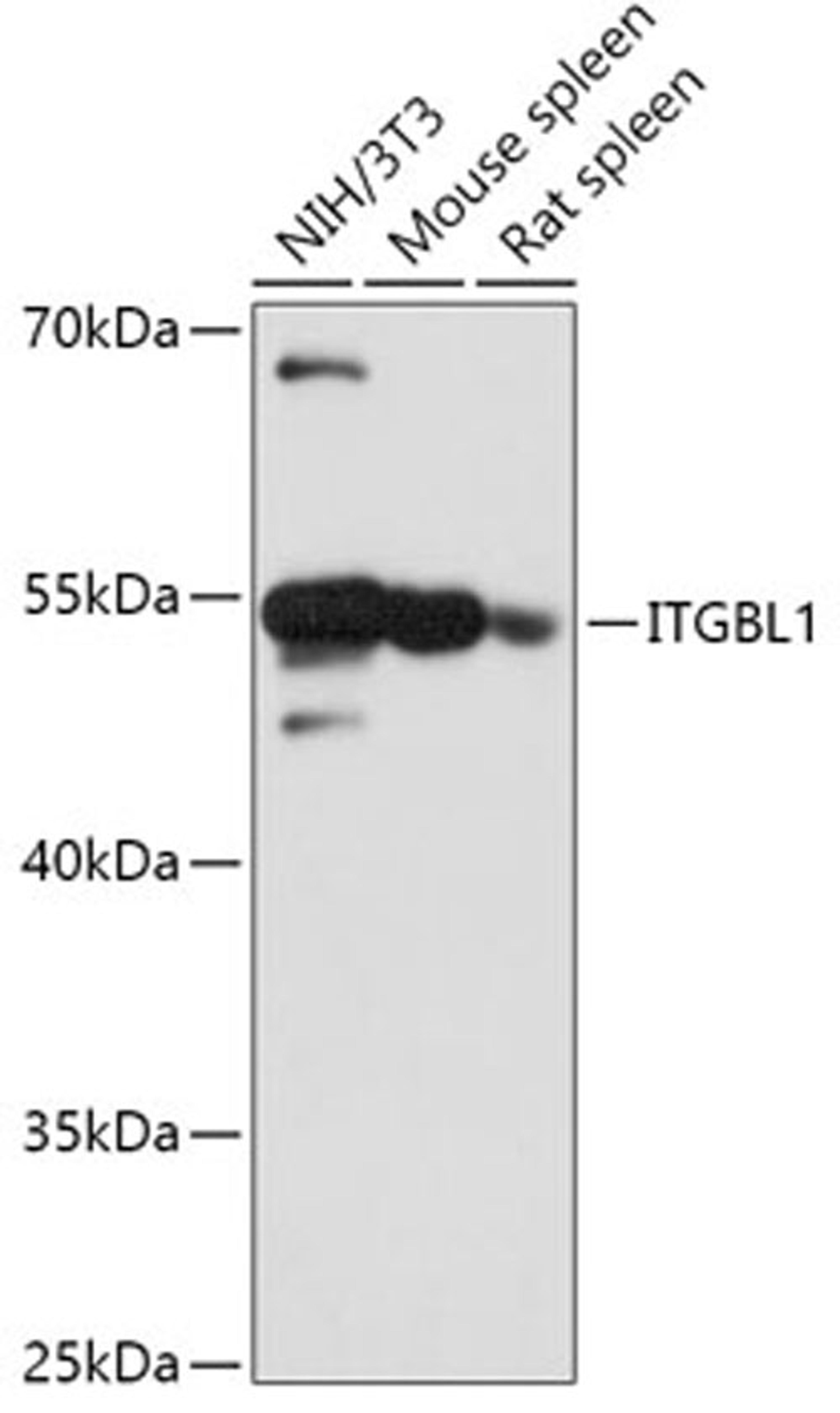 Western blot - ITGBL1 antibody (A17592)