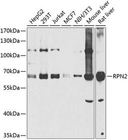 Western blot - RPN2 antibody (A8352)