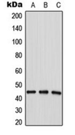 Western blot analysis of HepG2 (Lane 1), MDAMB435 (Lane 2), MCF7 (Lane 3) whole cell lysates using LPAAT delta antibody