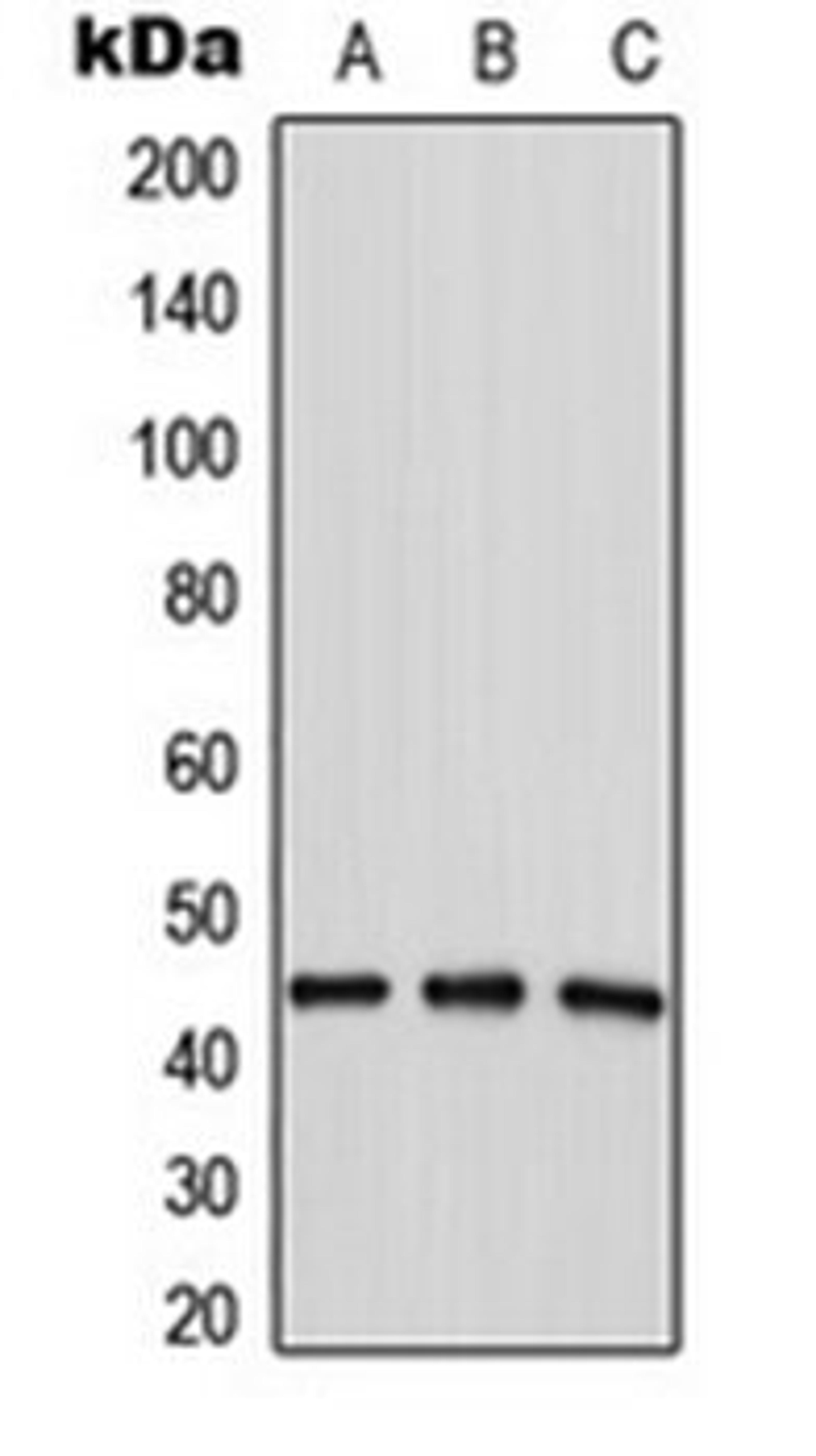 Western blot analysis of HepG2 (Lane 1), MDAMB435 (Lane 2), MCF7 (Lane 3) whole cell lysates using LPAAT delta antibody