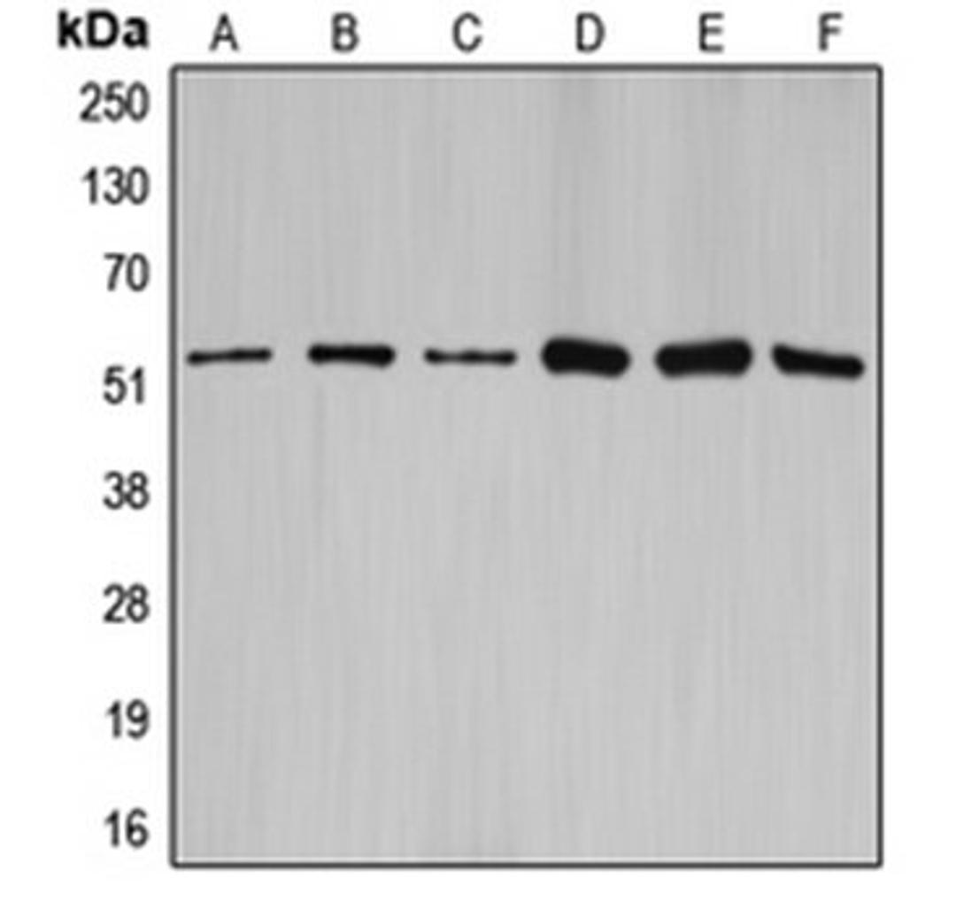 Western blot analysis of HEK293T (Lane 1), NIH3T3 (Lane 2), rat brain (Lane 3), SW626 (Lane 4), SKOV3 (Lane 5), A2780 (Lane 6) whole cell lysates using CCNA1 antibody