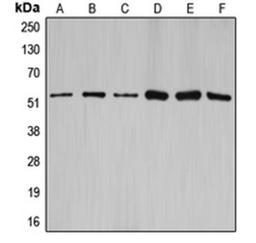 Western blot analysis of HEK293T (Lane 1), NIH3T3 (Lane 2), rat brain (Lane 3), SW626 (Lane 4), SKOV3 (Lane 5), A2780 (Lane 6) whole cell lysates using CCNA1 antibody