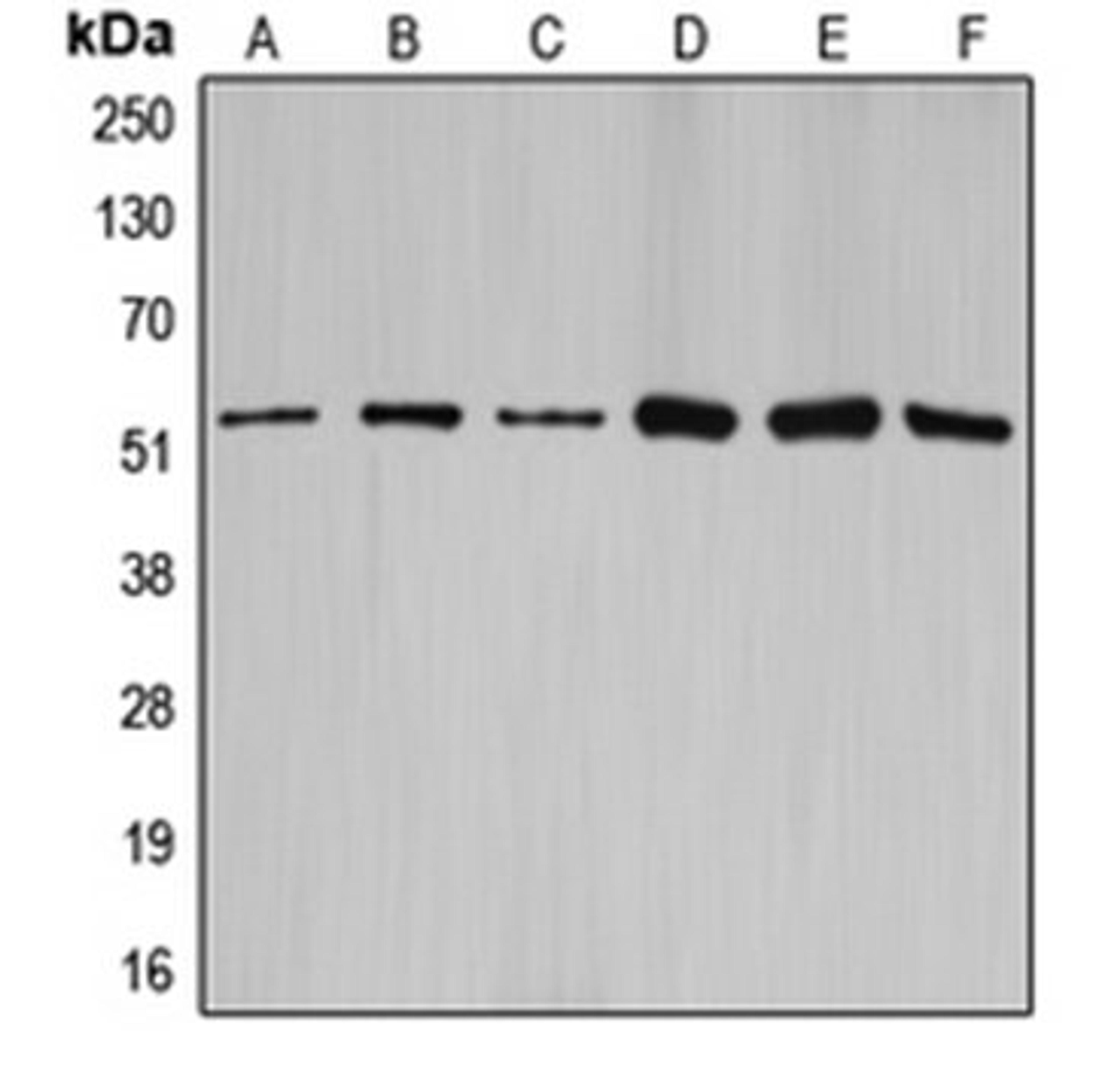 Western blot analysis of HEK293T (Lane 1), NIH3T3 (Lane 2), rat brain (Lane 3), SW626 (Lane 4), SKOV3 (Lane 5), A2780 (Lane 6) whole cell lysates using CCNA1 antibody