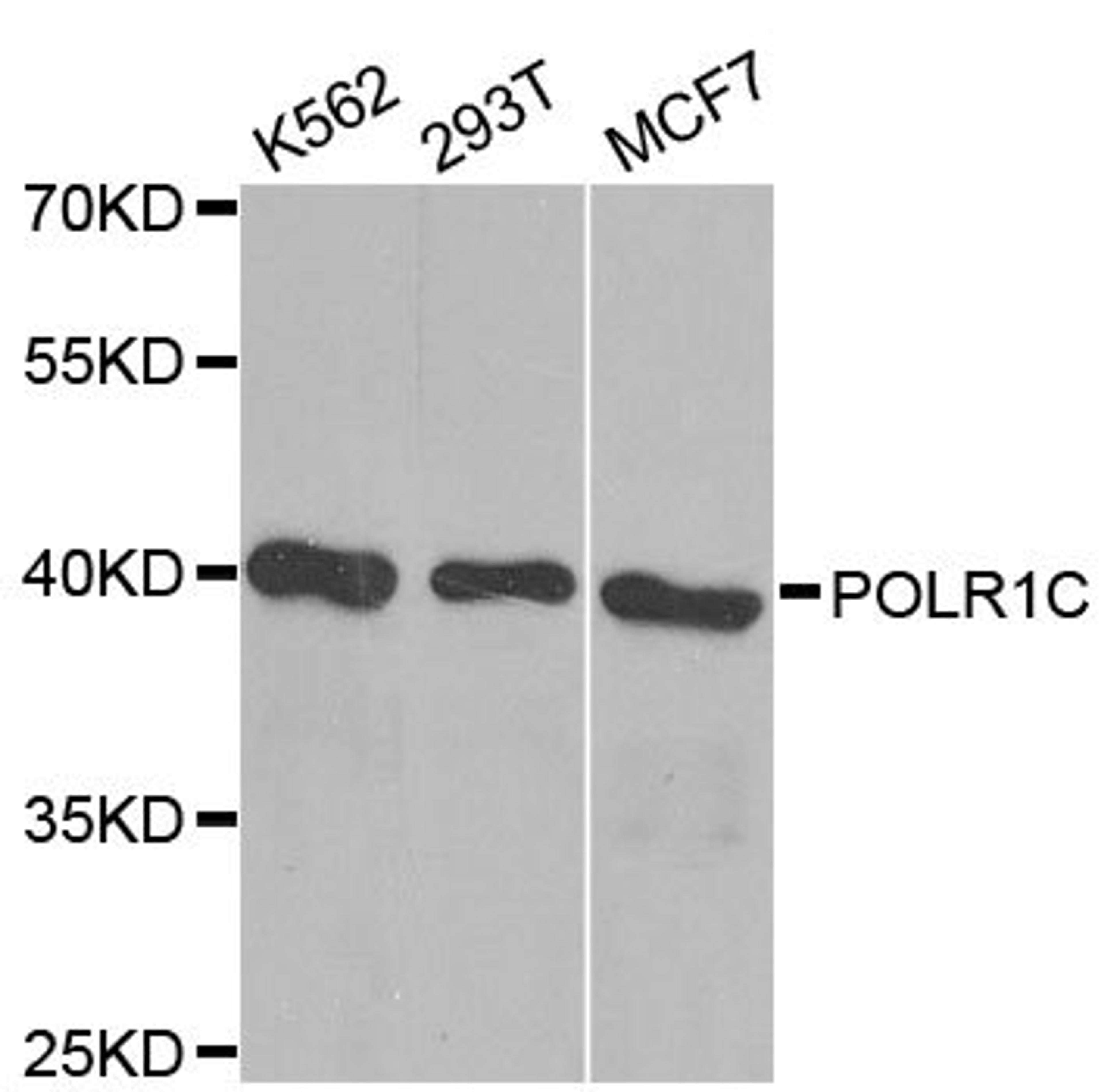 Western blot - POLR1C antibody (A0269)