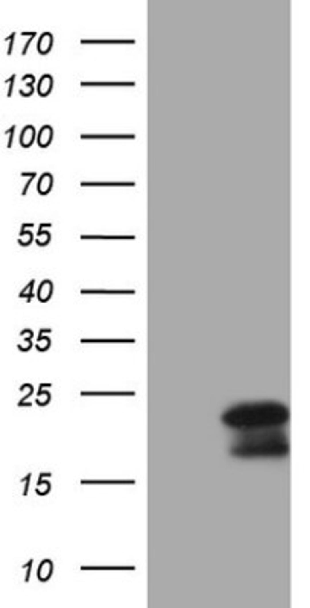 Western Blot: MCEE Antibody (1B5) [NBP2-45772] - Analysis of HEK293T cells were transfected with the pCMV6-ENTRY control (Left lane) or pCMV6-ENTRY MCEE.