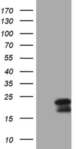 Western Blot: MCEE Antibody (1B5) [NBP2-45772] - Analysis of HEK293T cells were transfected with the pCMV6-ENTRY control (Left lane) or pCMV6-ENTRY MCEE.