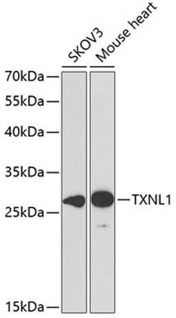 Western blot - TXNL1 antibody (A6322)