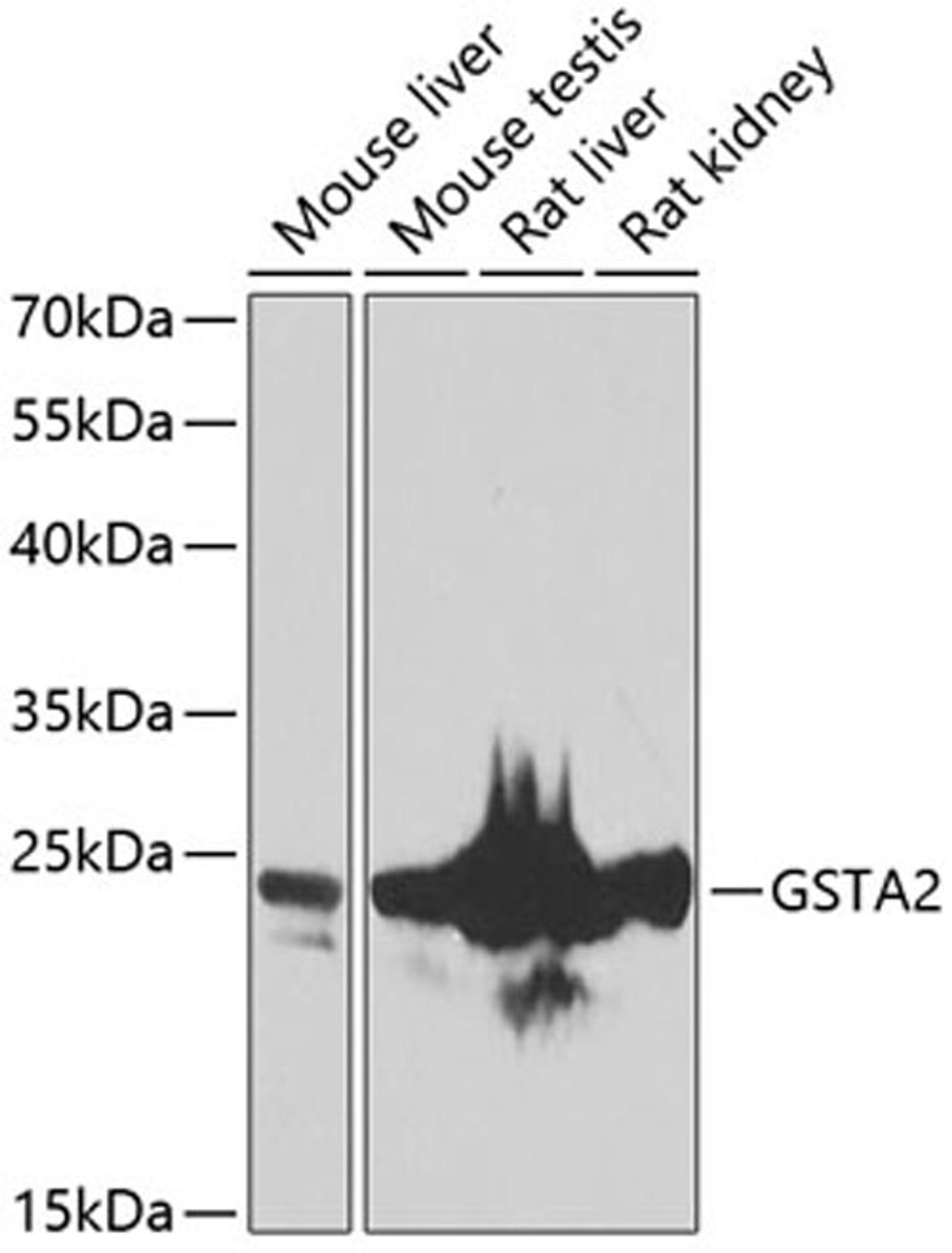 Western blot - GSTA2 antibody (A7678)