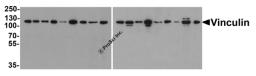 Western blot analysis of Vinculin in 293, A431, A549, HeLa, HepG2, K562, 3T3, Raji, U937 cell lysate and rat heart, mouse lung, rat lung, mouse spleen, rat spleen, rabbit spleen, mouse brain, rabbit brain and chicken spleen tissue lysate with Vinculin ant