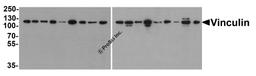 Western blot analysis of Vinculin in 293, A431, A549, HeLa, HepG2, K562, 3T3, Raji, U937 cell lysate and rat heart, mouse lung, rat lung, mouse spleen, rat spleen, rabbit spleen, mouse brain, rabbit brain and chicken spleen tissue lysate with Vinculin ant