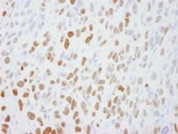 Detection of mouse DBC1/p30 by immunohistochemistry.