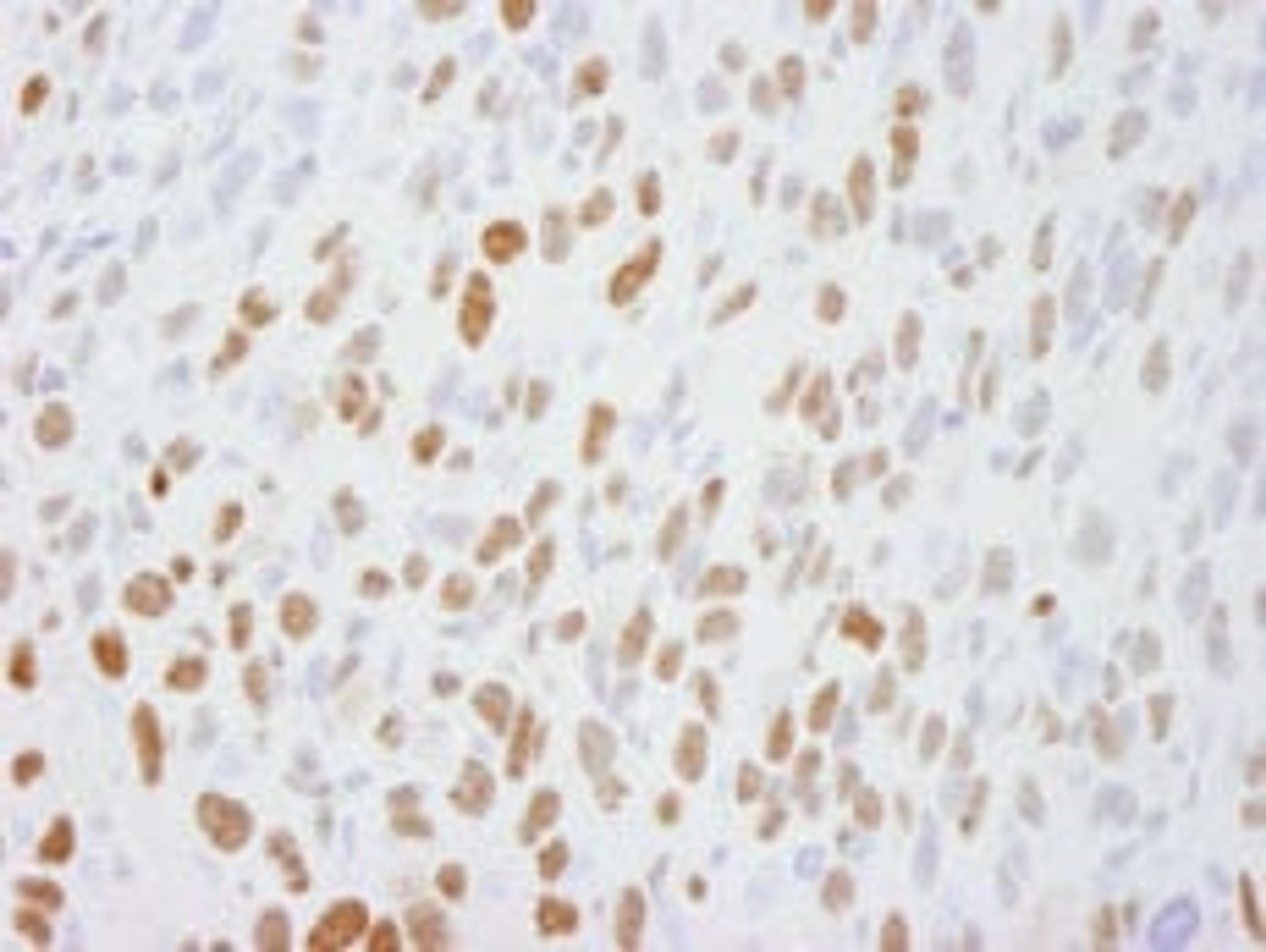 Detection of mouse DBC1/p30 by immunohistochemistry.