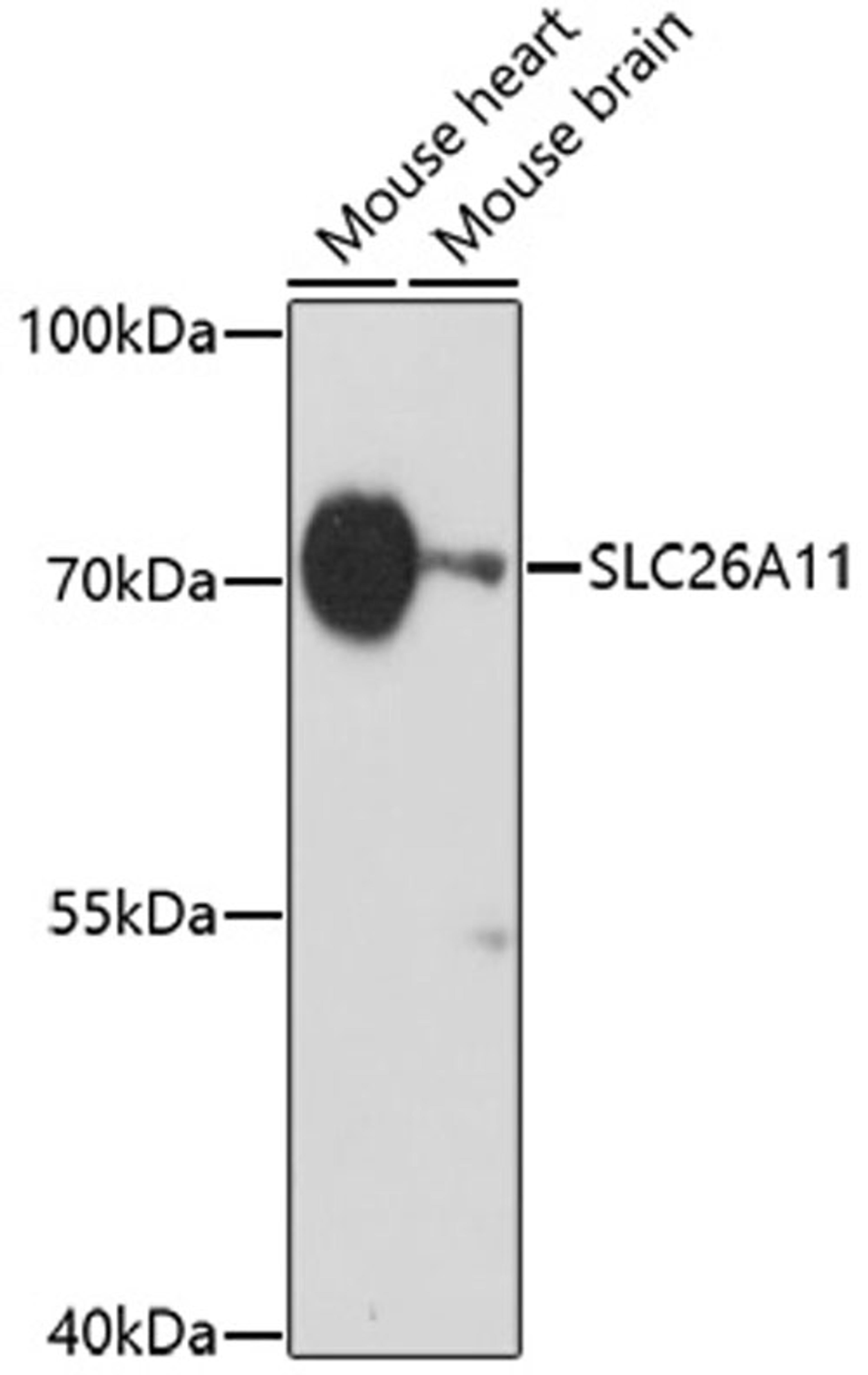 Western blot - SLC26A11 antibody (A17276)