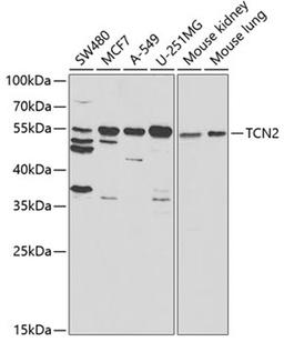 Western blot - TCN2 antibody (A5755)