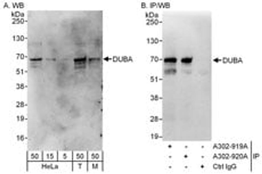 Detection of human and mouse DUBA by western blot (h&m) and immunoprecipitation (h).