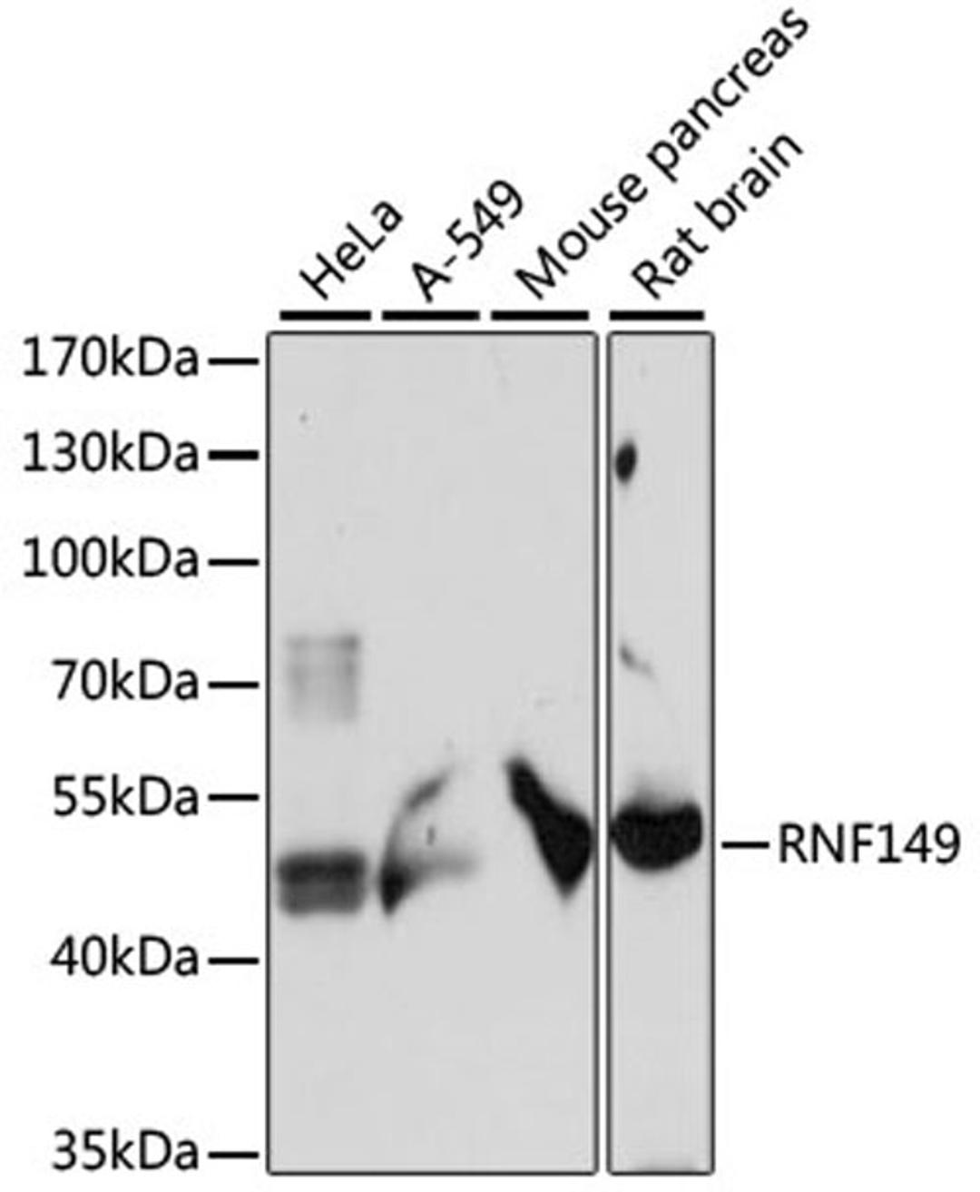 Western blot - RNF149 antibody (A15627)