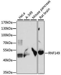 Western blot - RNF149 antibody (A15627)