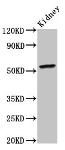 Western Blot. Positive WB detected in: Mouse kidney tissue. All lanes: CYP2C19 antibody at 4ug/ml. Secondary. Goat polyclonal to rabbit IgG at 1/50000 dilution. Predicted band size: 56 kDa. Observed band size: 56 kDa. 