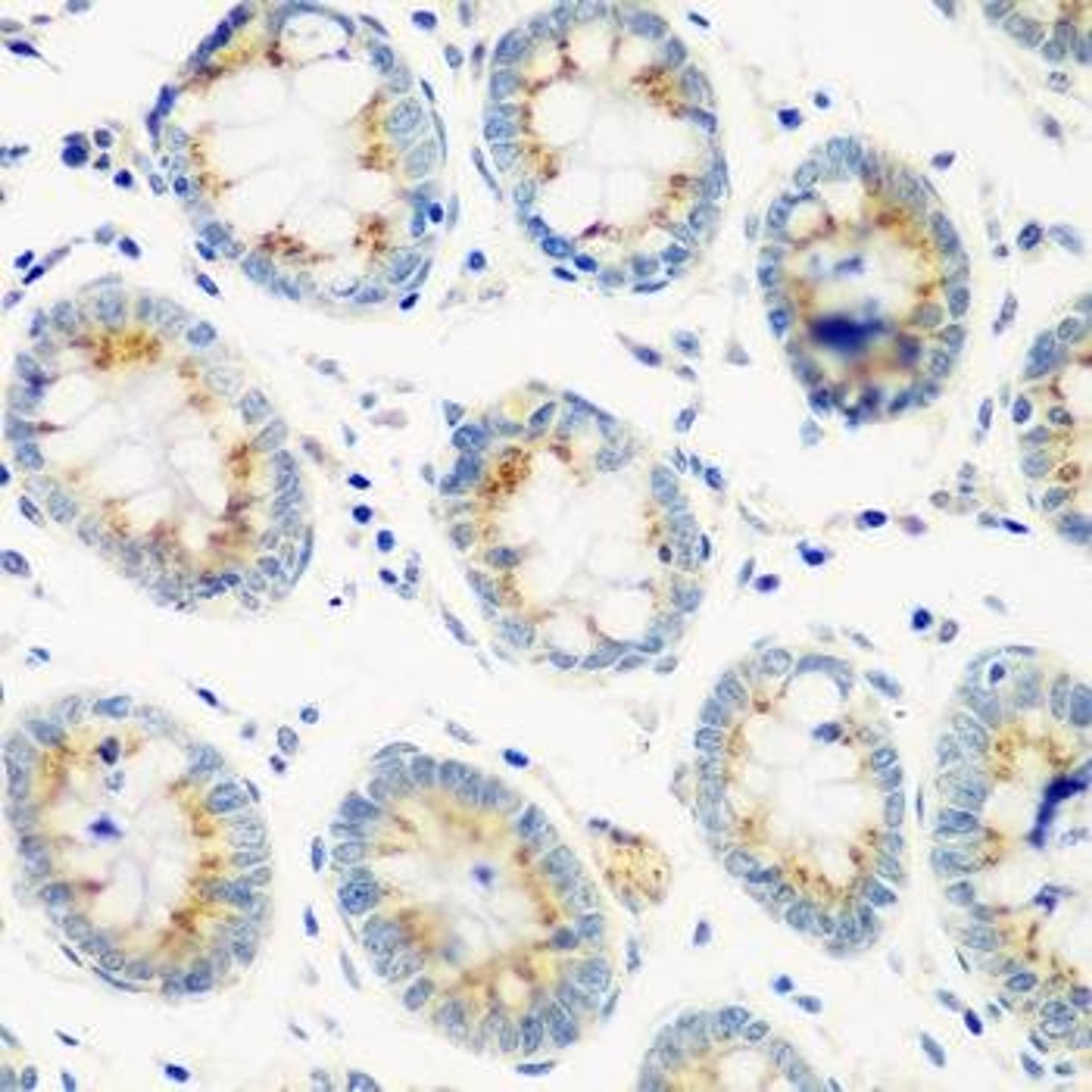 Immunohistochemical staining of human colon tissue using CTSG antibody (dilution of 1:100)