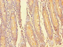 Immunohistochemistry of paraffin-embedded human small intestine tissue using CSB-PA873725LA01HU at dilution of 1:100
