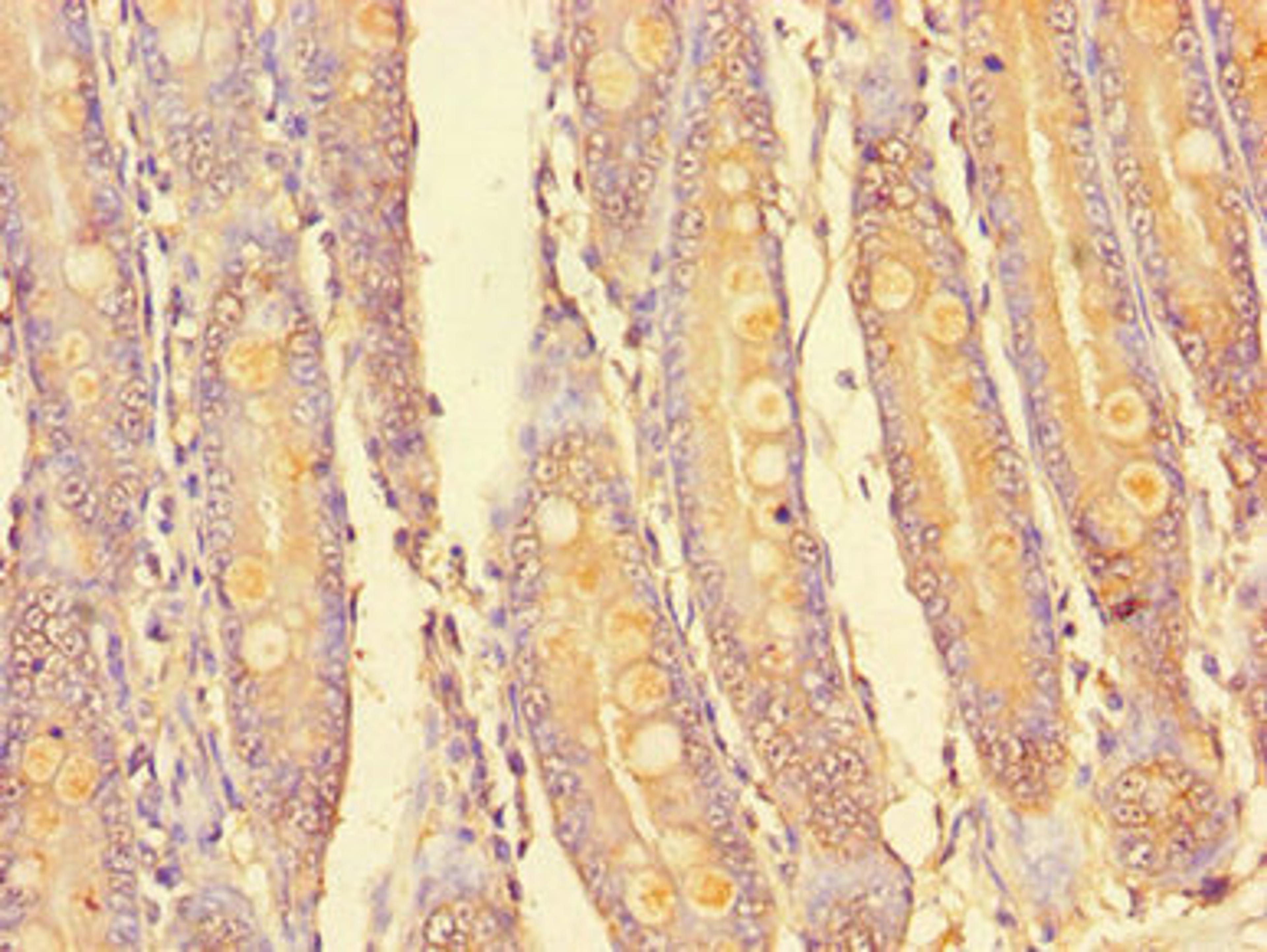 Immunohistochemistry of paraffin-embedded human small intestine tissue using CSB-PA873725LA01HU at dilution of 1:100