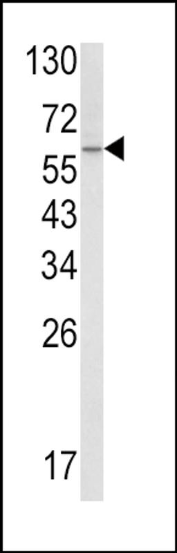 Western blot analysis of SCP2 Antibody in A2058 cell line lysates (35ug/lane)