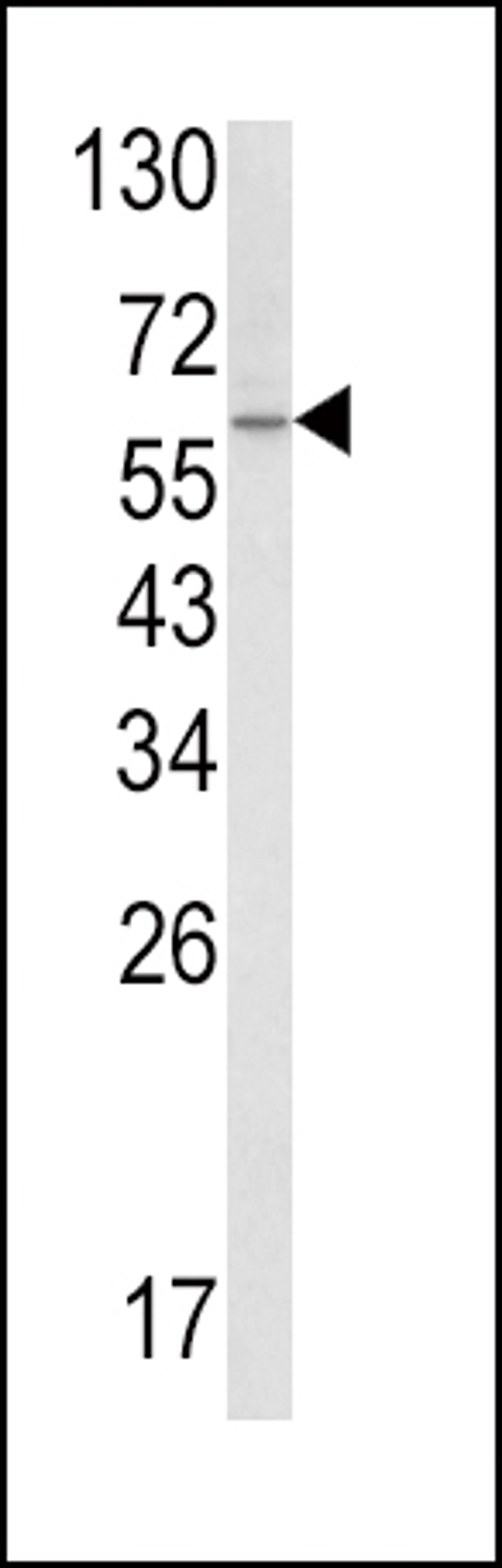 Western blot analysis of SCP2 Antibody in A2058 cell line lysates (35ug/lane)