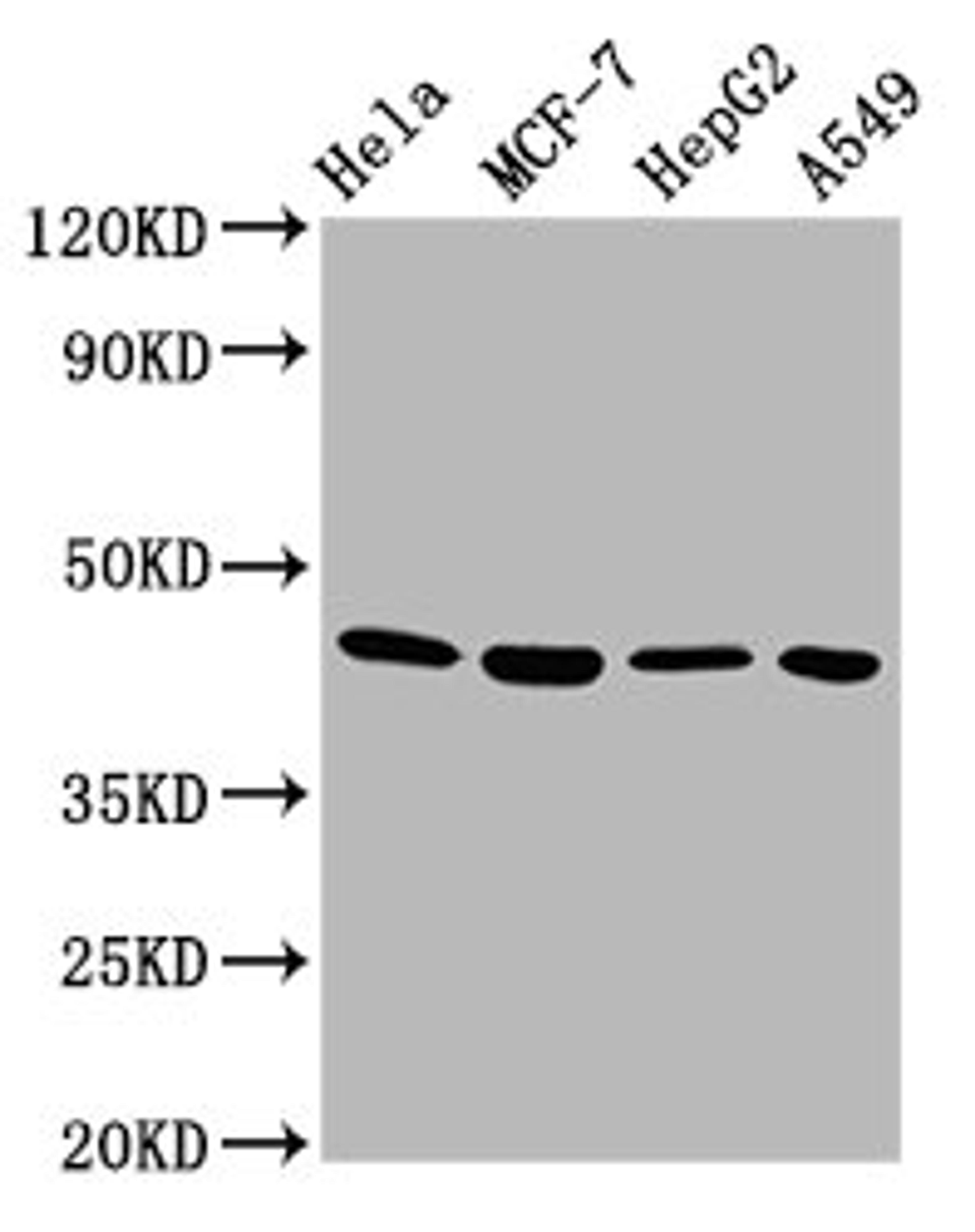 Western Blot. Positive WB detected in: Hela whole cell lysate, MCF-7 whole cell lysate, HepG2 whole cell lysate, A549 whole cell lysate. All lanes: GNA12 antibody at 5.8µg/ml. Secondary. Goat polyclonal to rabbit IgG at 1/50000 dilution. Predicted band size: 45, 38, 35 kDa. Observed band size: 45 kDa