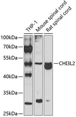 Western blot - CHI3L2 antibody (A7654)