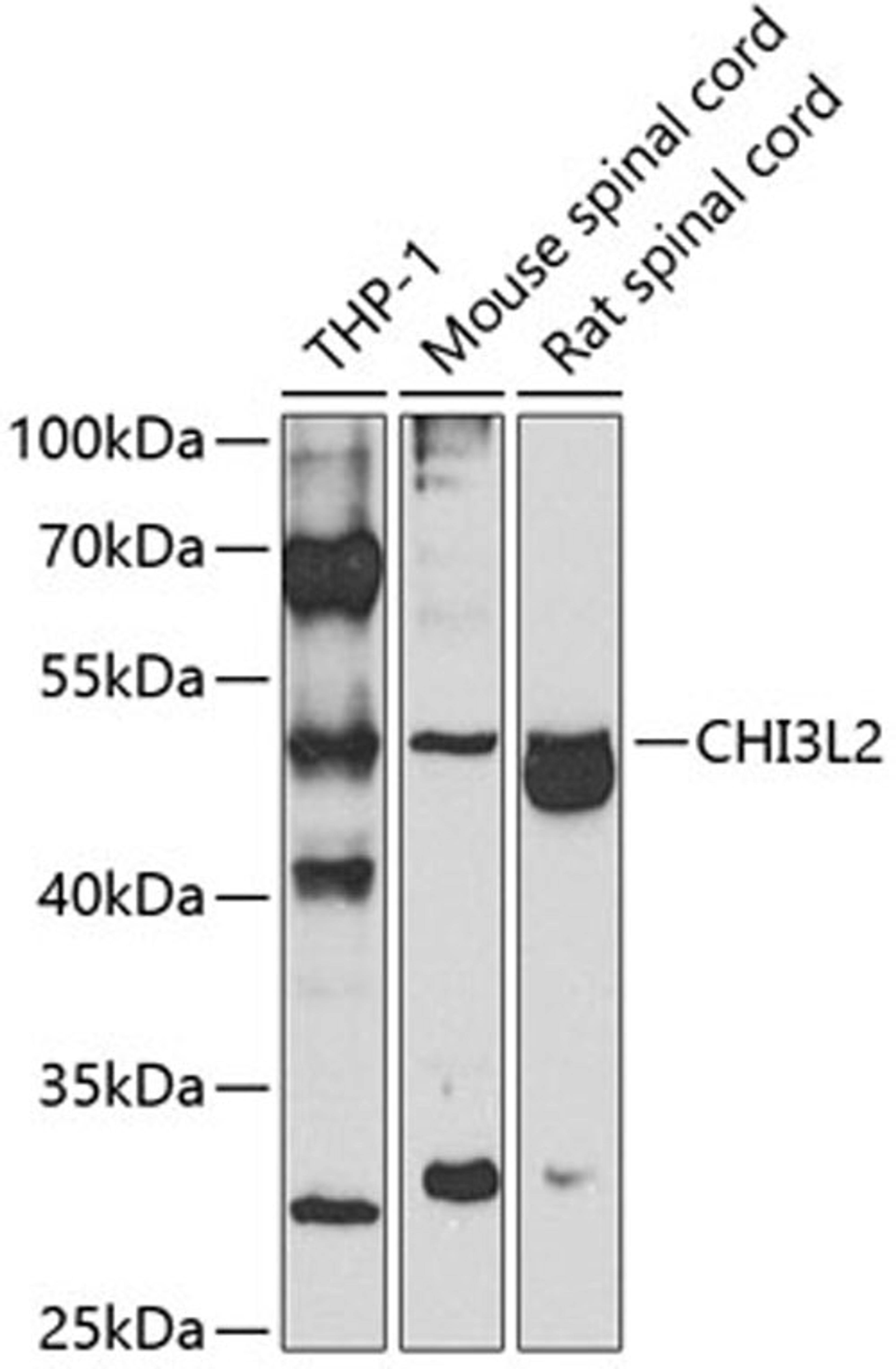 Western blot - CHI3L2 antibody (A7654)