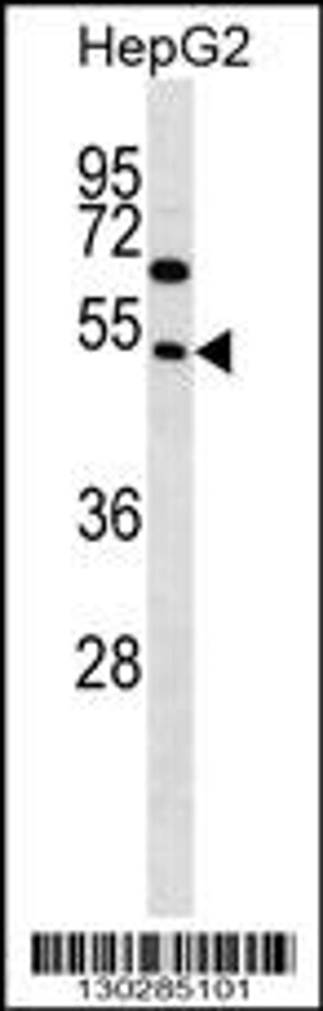 Western blot analysis in HepG2 cell line lysates (35ug/lane).