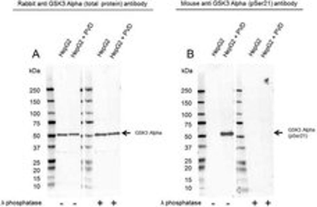 Western Blot analysis of HepG2 untreated and PVD treated whole cell lysates