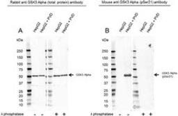 Western Blot analysis of HepG2 untreated and PVD treated whole cell lysates