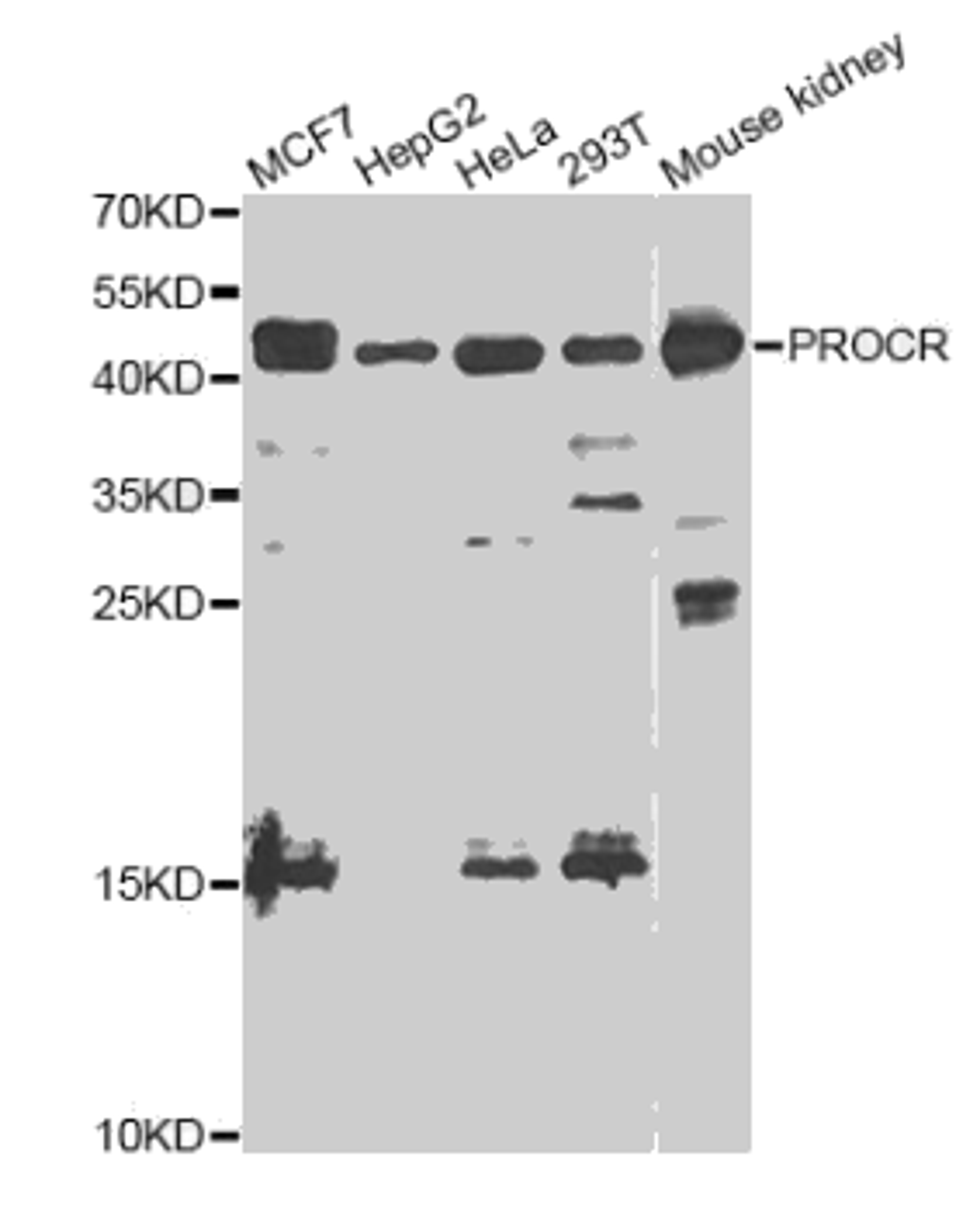 Western blot analysis of extracts of various cell lines, using PROCR antibody